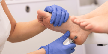 10 Reasons You Need to See a Podiatrist